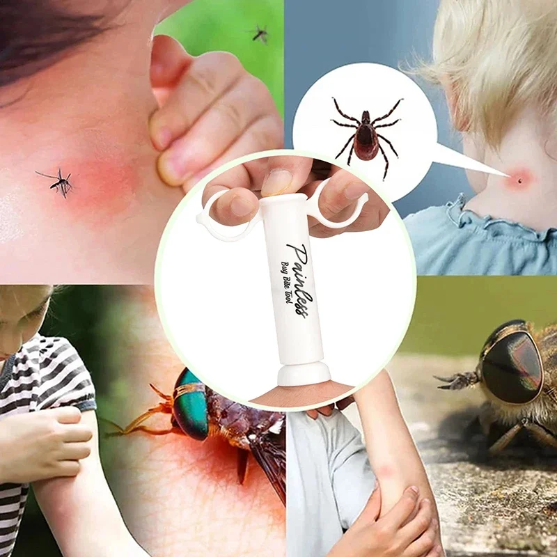 Insect Bite Suction Venom Extr - Outdoor Furniture Hay review and price