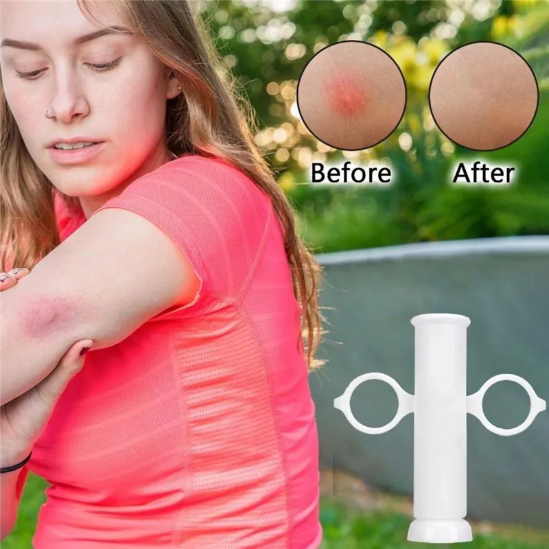 Insect Bite Suction Venom Extr - Outdoor Furniture Hay review and price